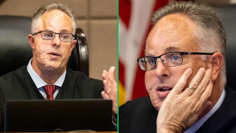 Judge Robert Hodges Accident: The Facial Scars